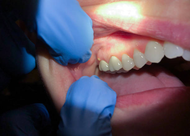 Best Urgent Dental Care for Toothache in Utica, MI