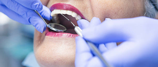 Best Emergency Dentist for Lost Fillings or Crowns in Utica, MI